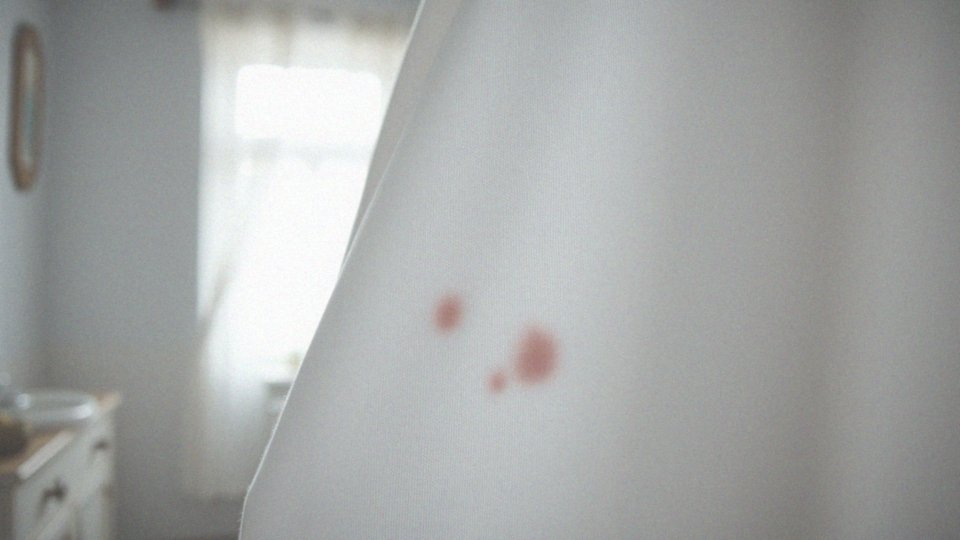 Czerwone swędzące plamy na piersiach – przyczyny i diagnoza